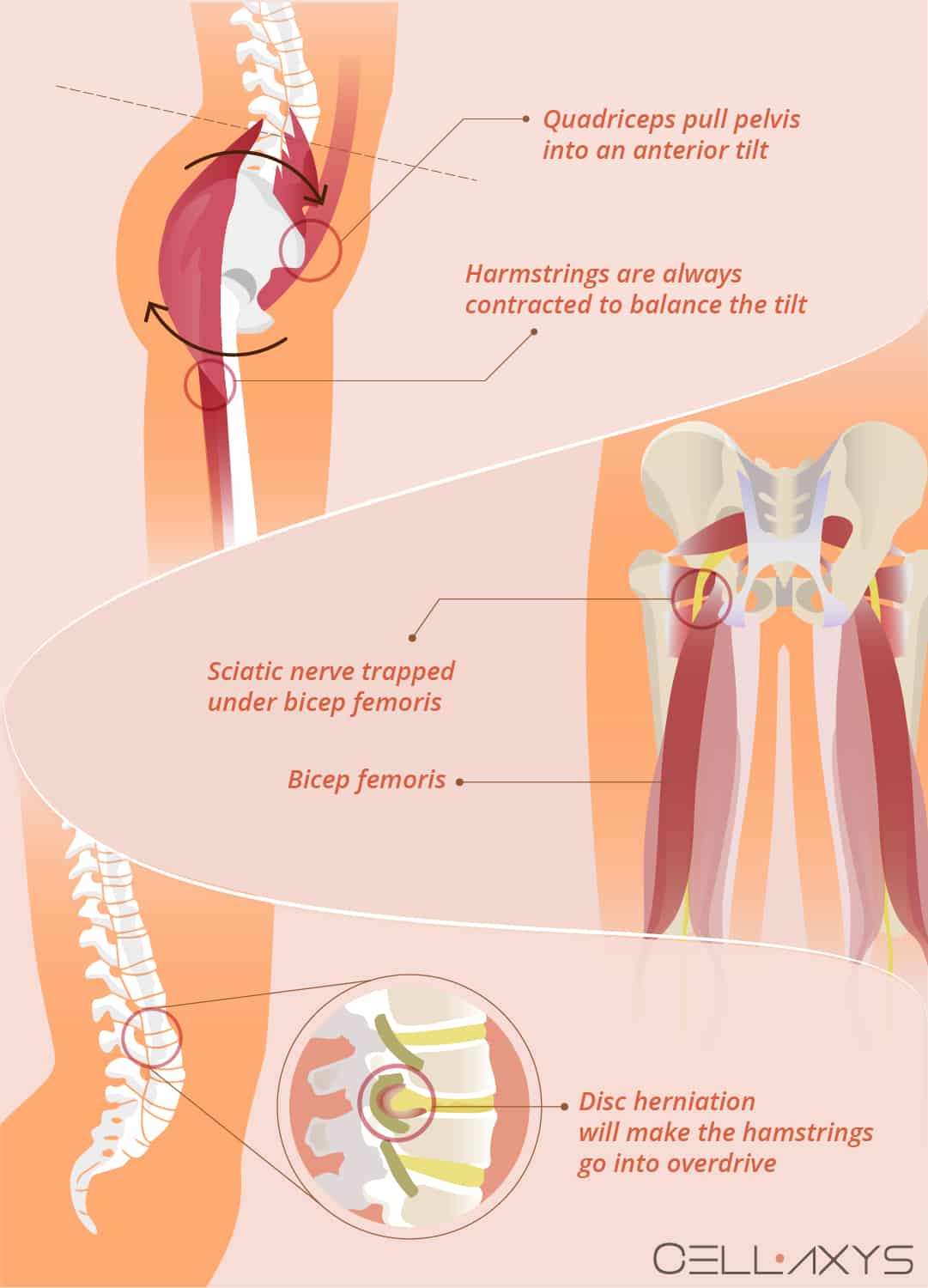 Causes knee pain Knee pain: