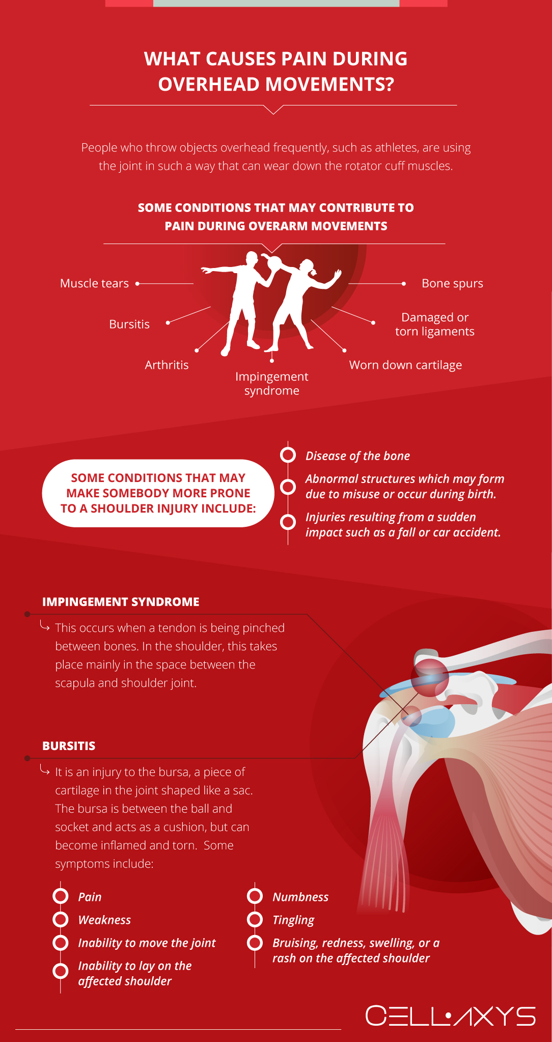 What Causes Pain During Overhead Movements