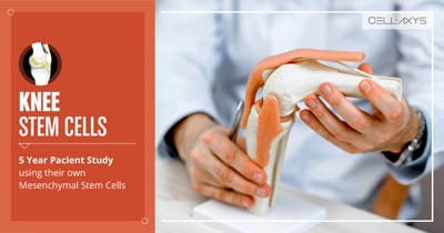 knee stem cells