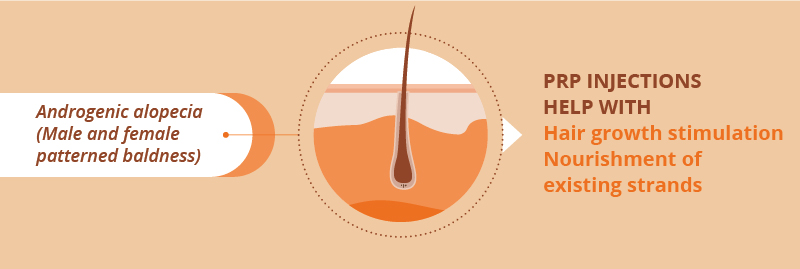 Platelet Rich Plasma Therapy