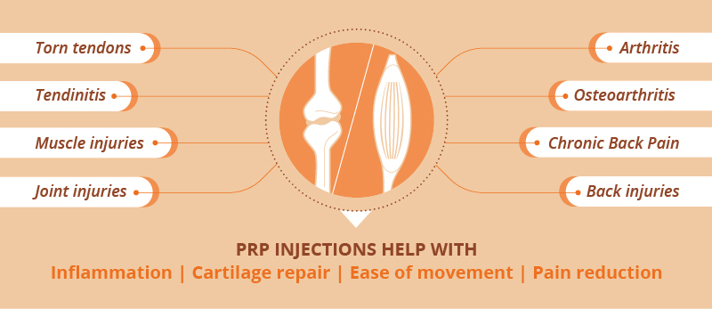 Platelet Rich Plasma Therapy