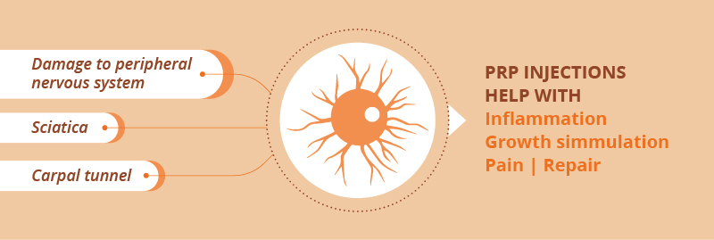 Platelet Rich Plasma Therapy