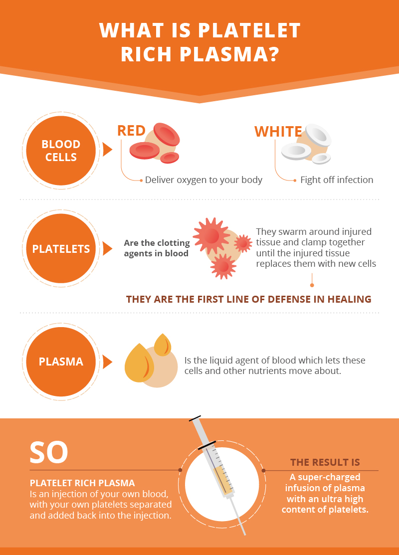 Platelet Rich Plasma Therapy