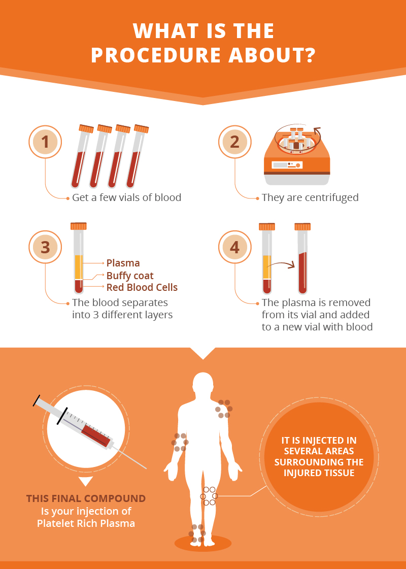 Platelet Rich Plasma Therapy Cellaxys