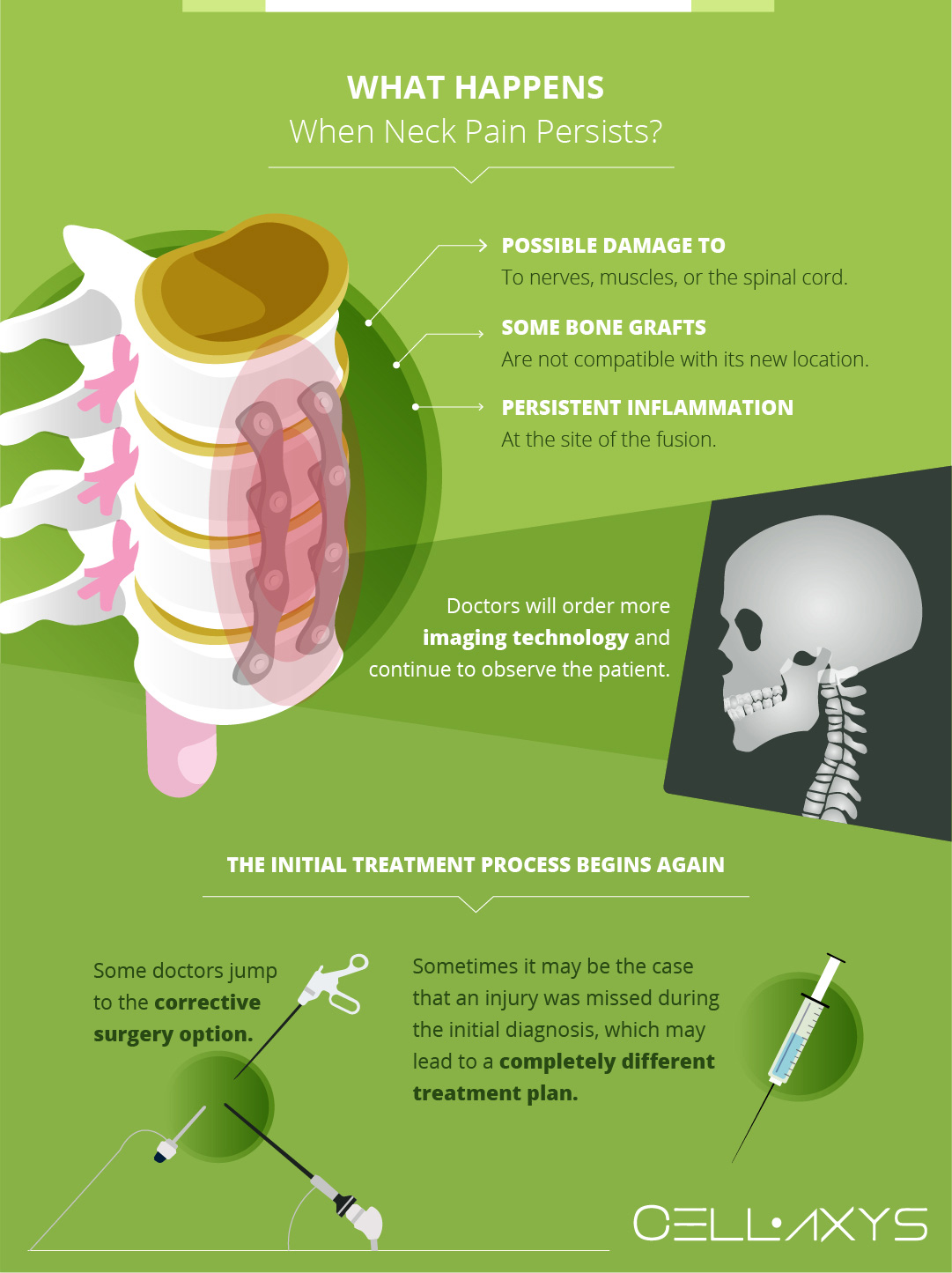 What Happens When Neck Pain Persists?