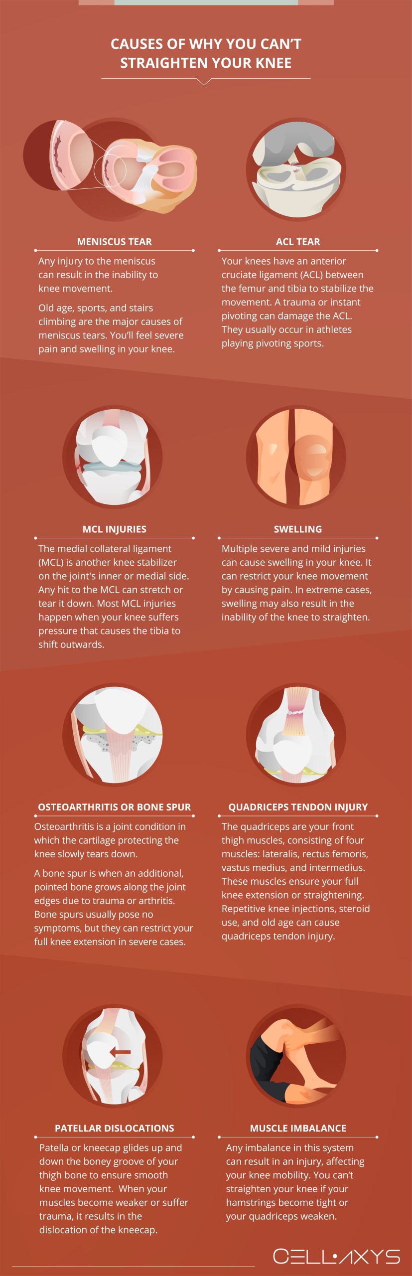 8 Reasons You Can't Straighten Knee - Cellaxys