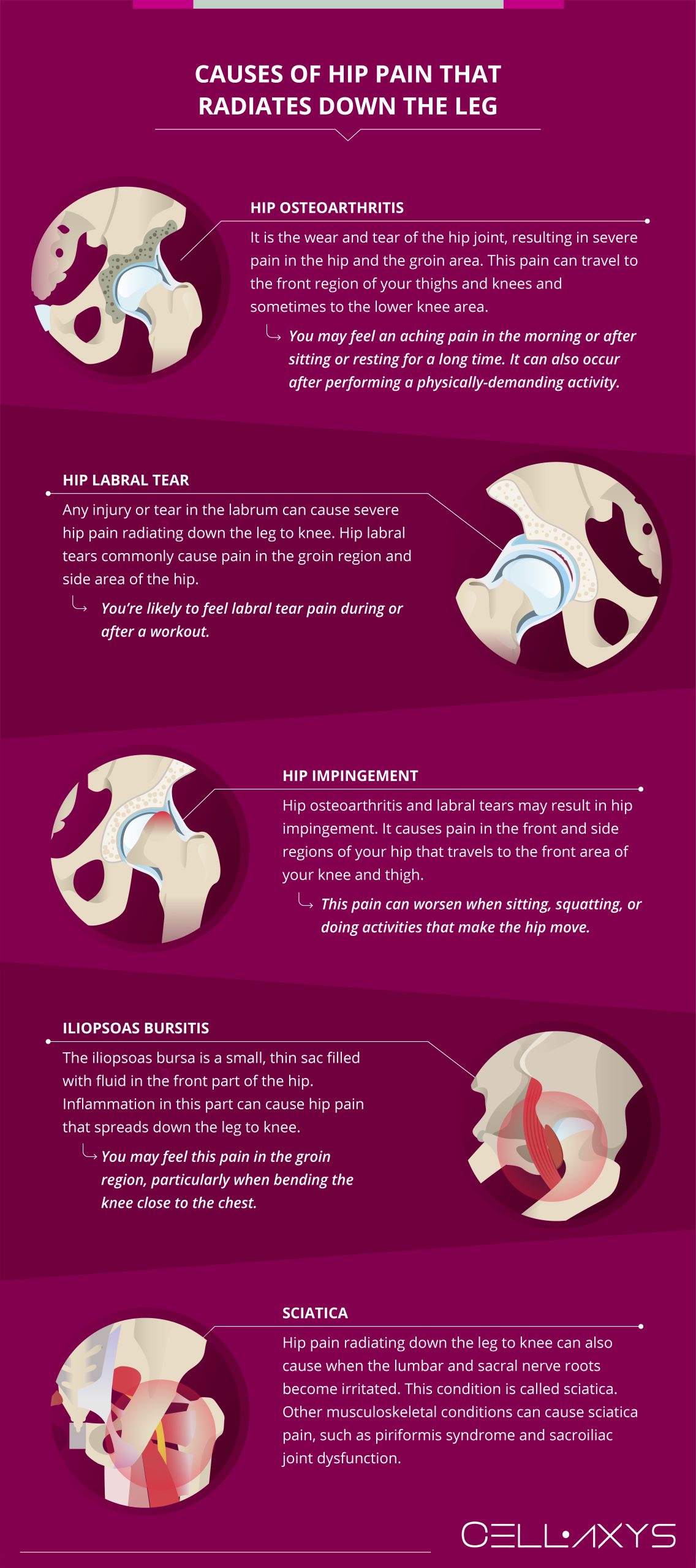 Causes of Hip Pain that Radiates Down the Leg 