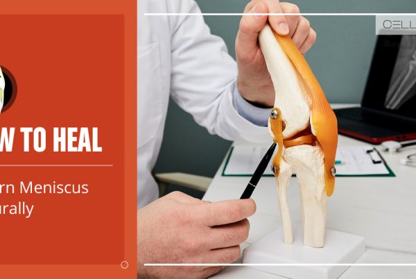 how to heal a torn meniscus naturally