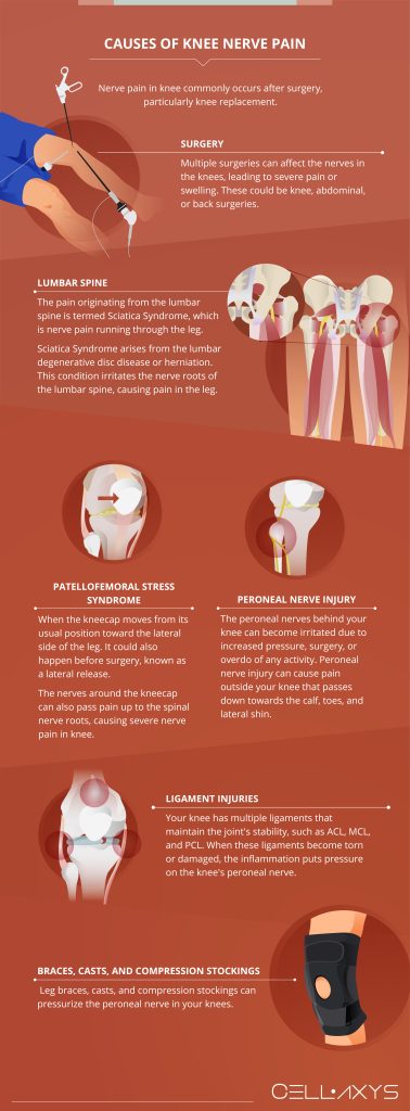 Nerve Pain In Knee: Causes, Symptoms, And Treatment - Cellaxys