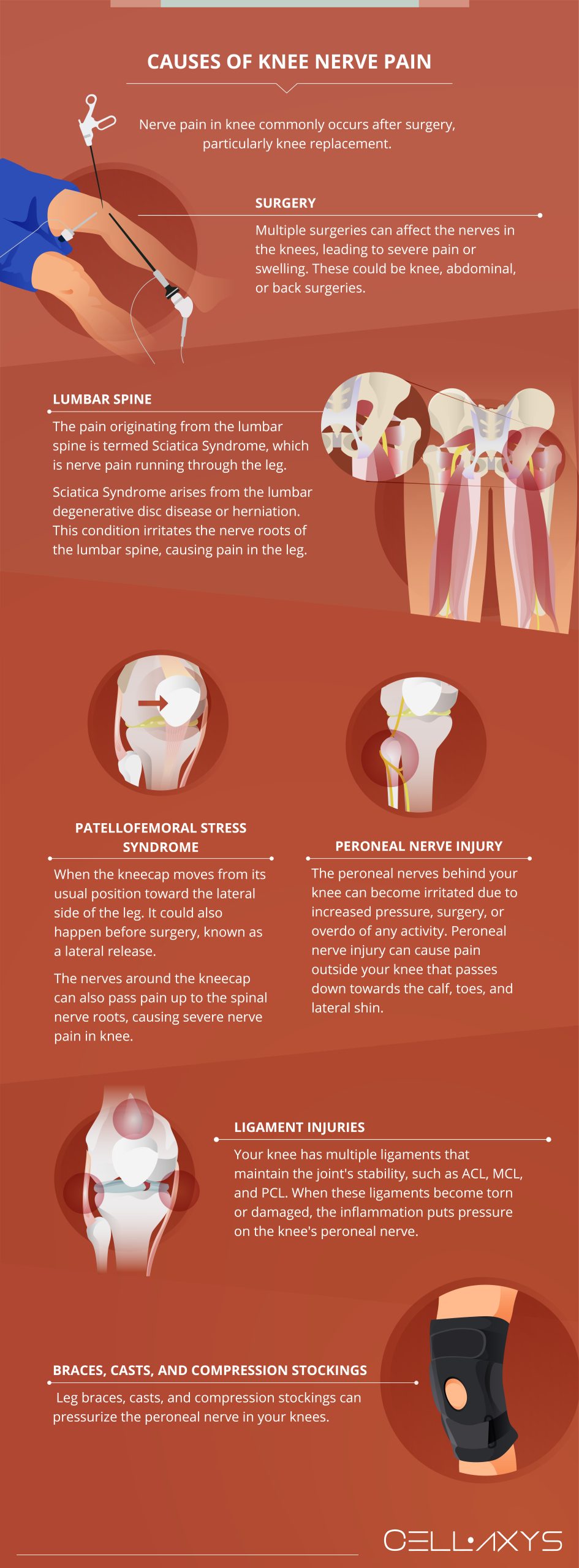 Nerve Pain In Knee Causes Symptoms And Treatment Scaled 