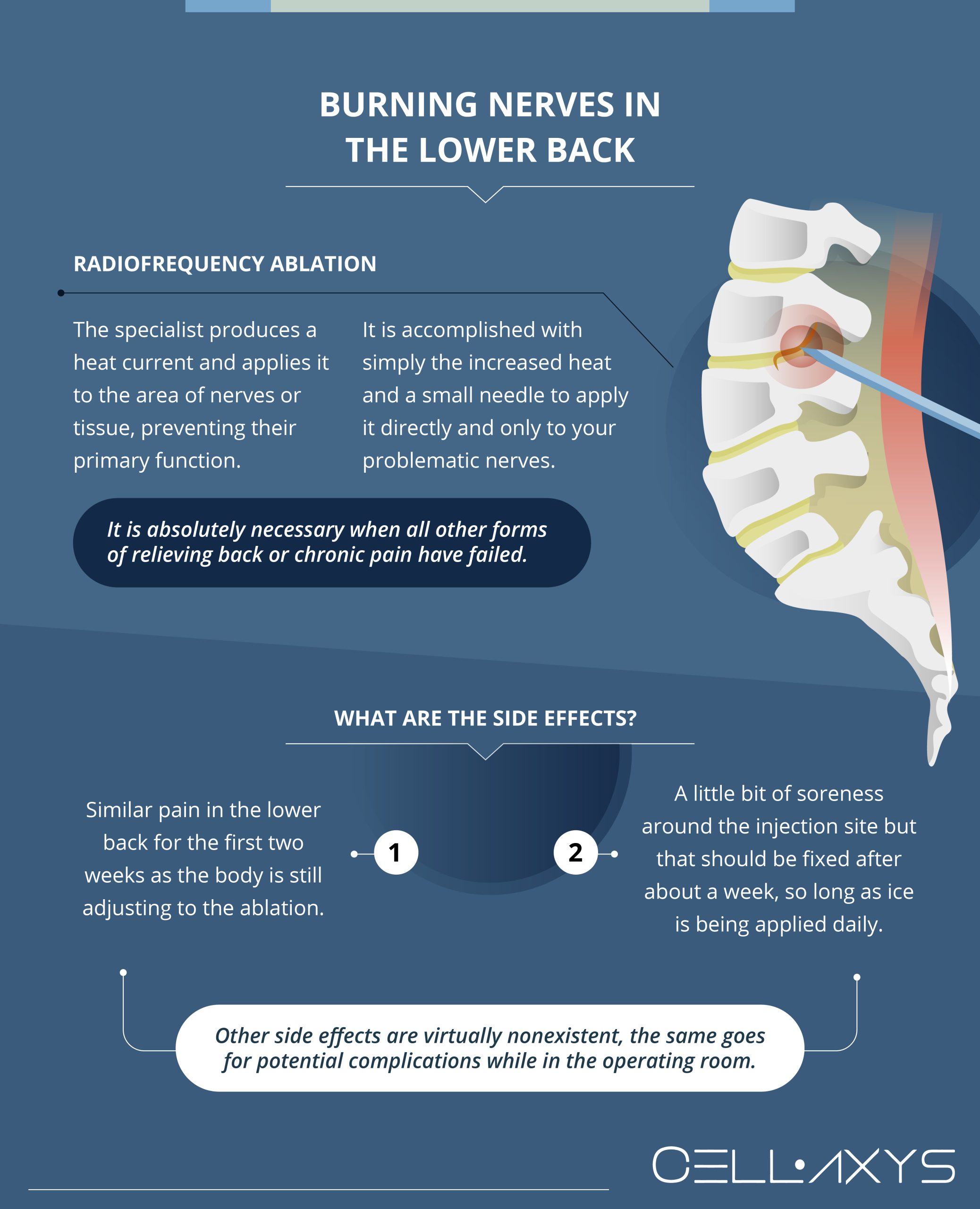 pinched-low-back-nerve