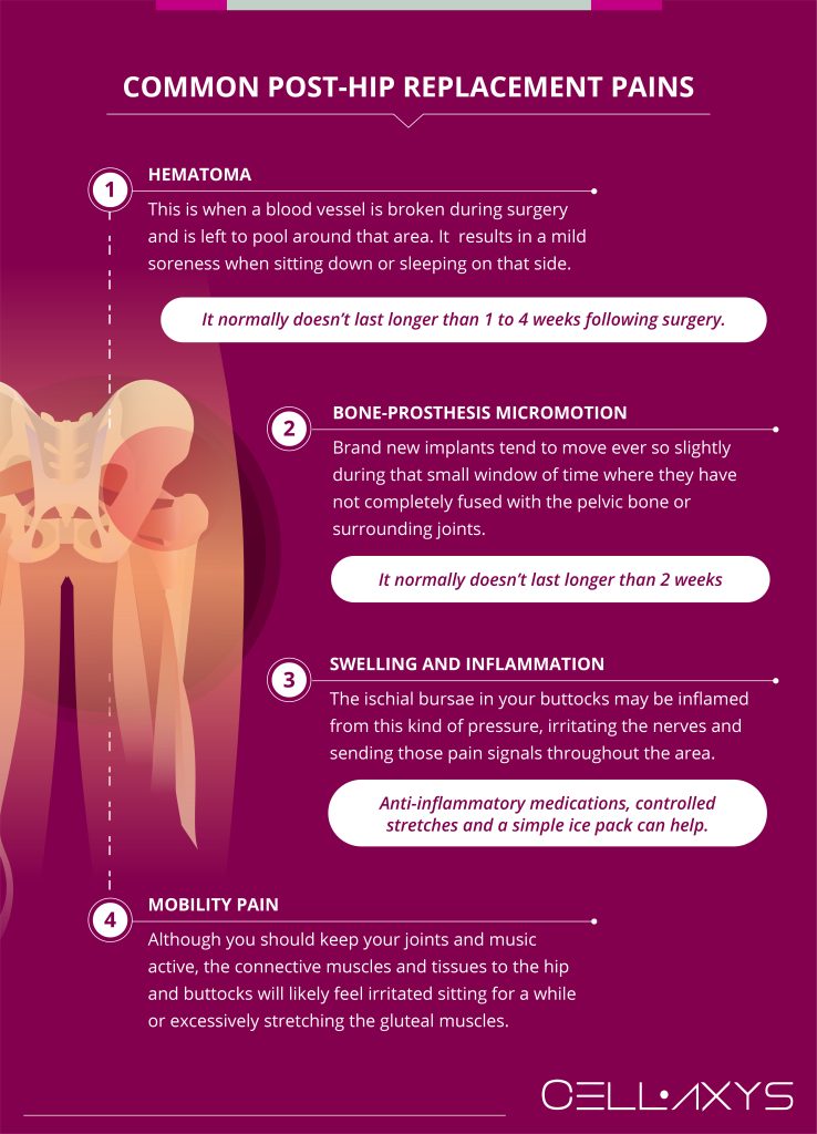 The Cause Of Buttock Pain After Hip Replacement - Cellaxys