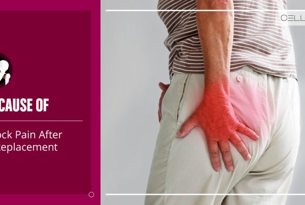 Cause of Buttock Pain after Hip Replacement