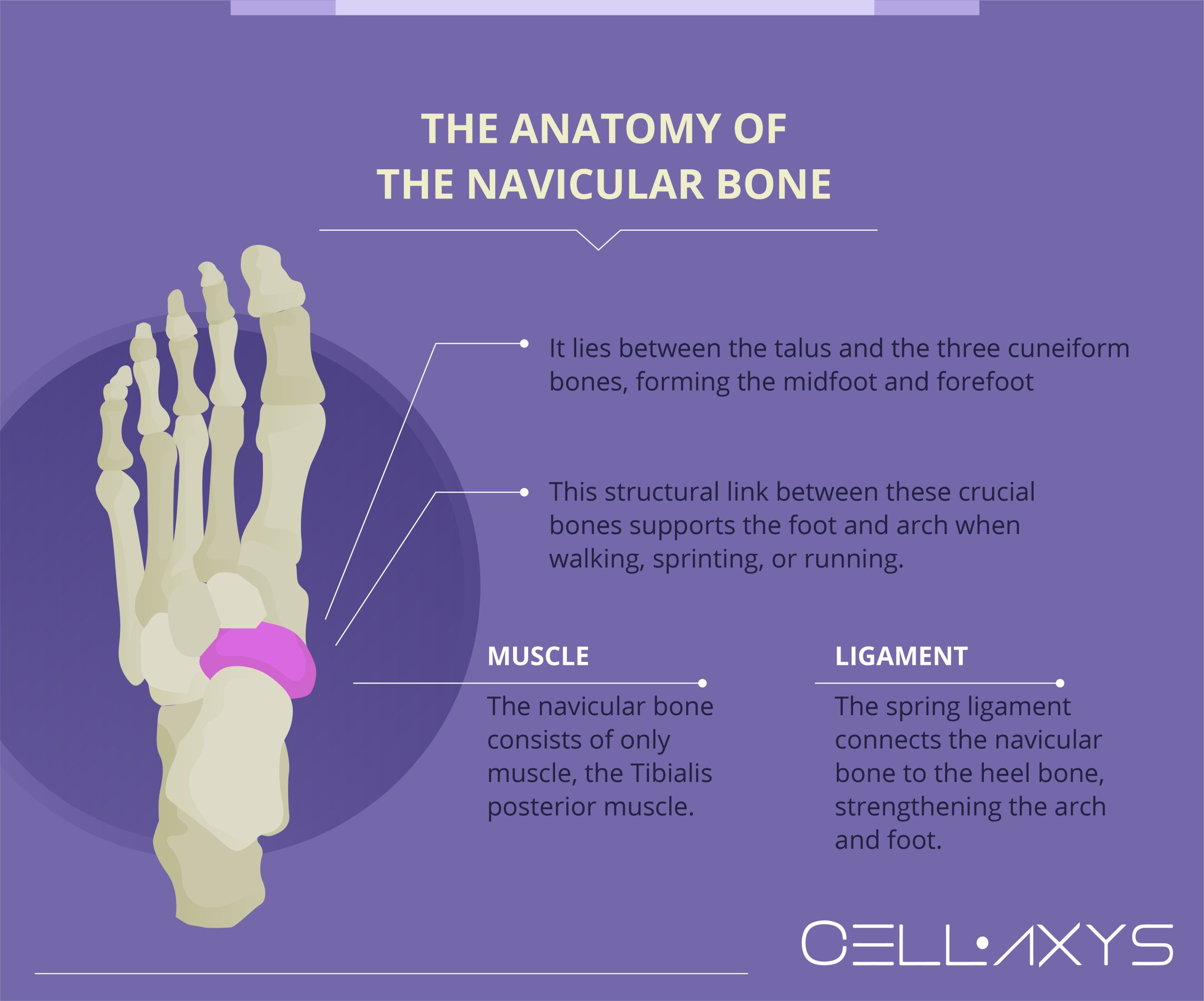 cuneiform bone swelling