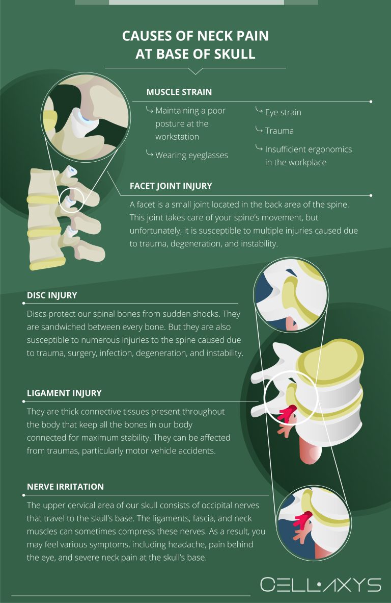 Neck Pain At Base Of Skull: Symptoms, Causes, And Treatment - Cellaxys