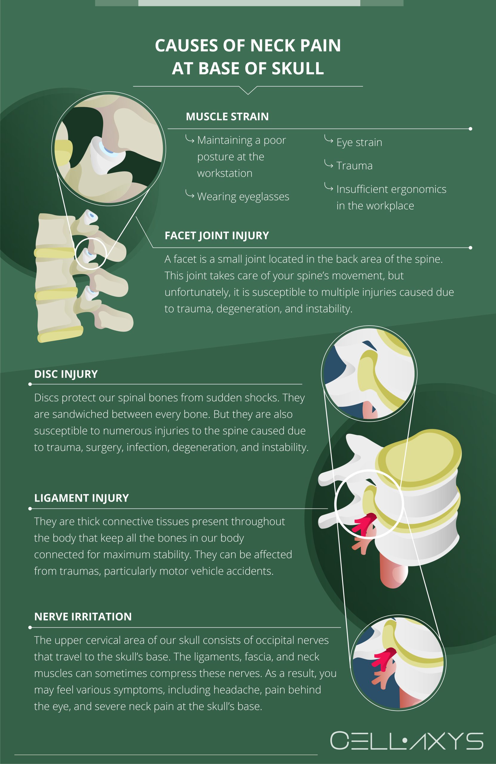 Causes of skull based neck pain