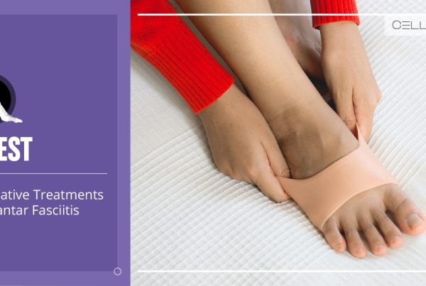 alternative treatment for plantar fasciitis
