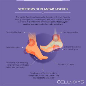 Plantar Fasciitis So Bad I Can't Walk: How To Make It Better? - Cellaxys