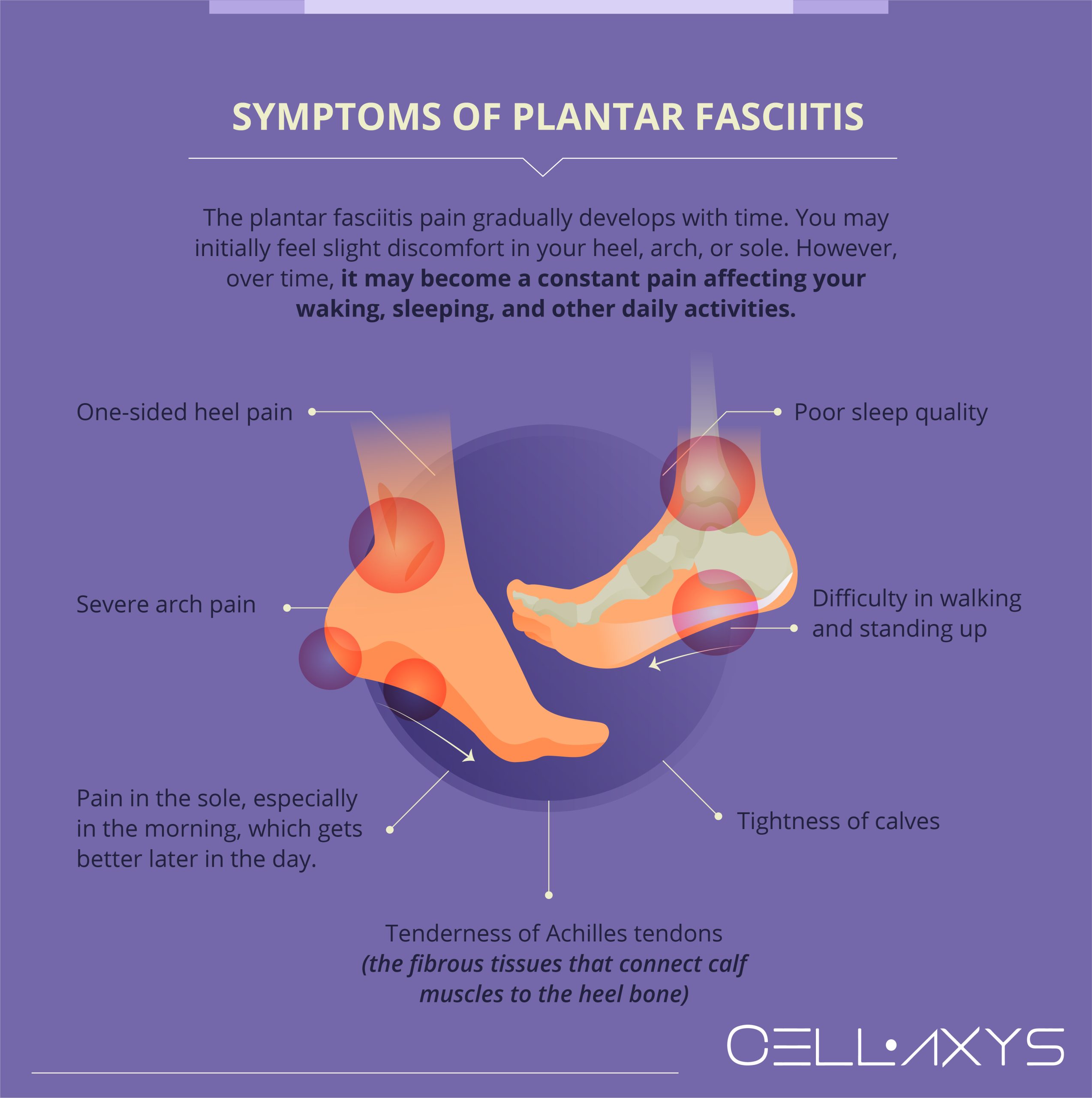Symptoms of Plantar Fasciitis