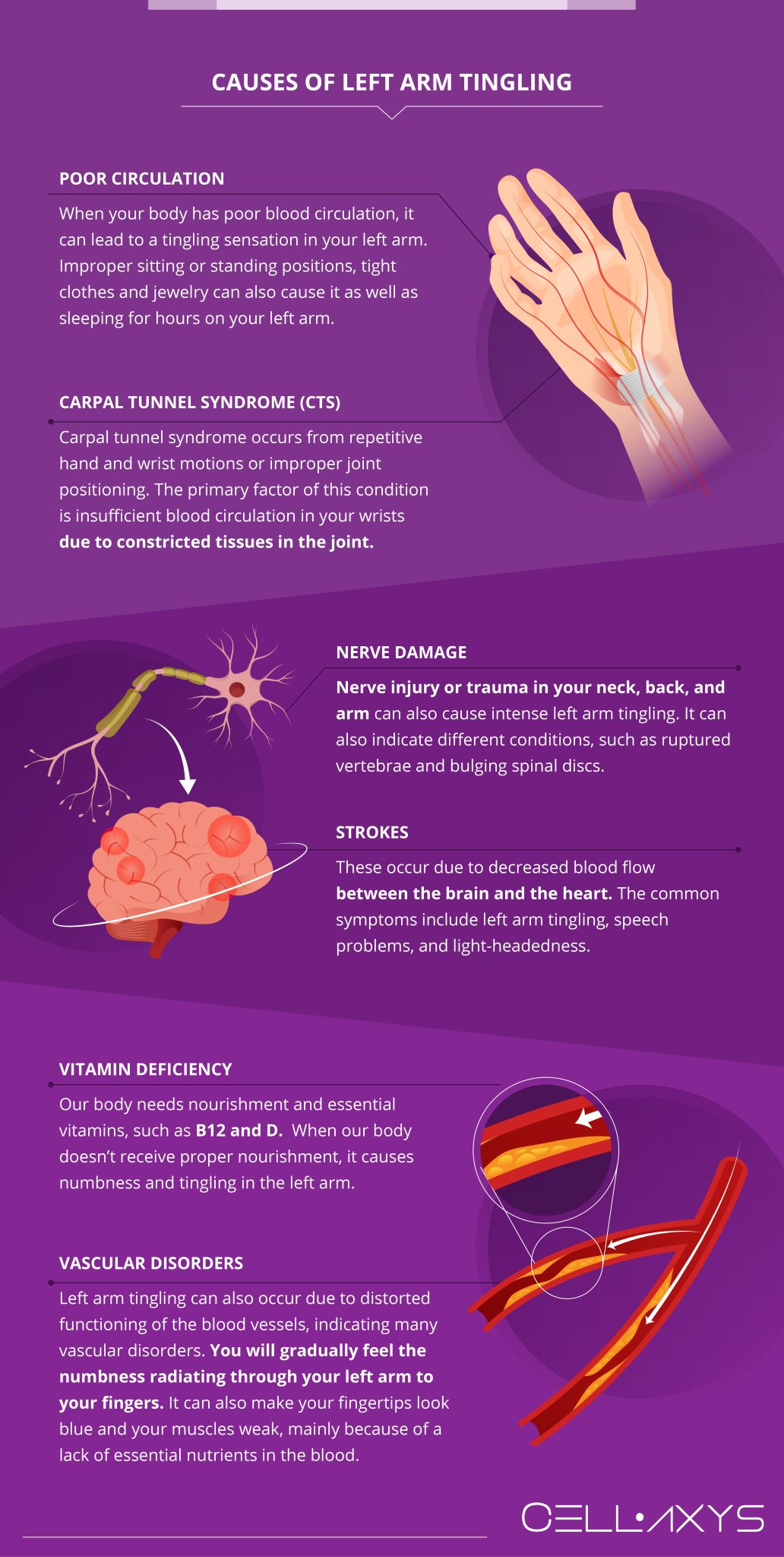 What Causes Left Arm Tingling How To Treat It Cellaxys