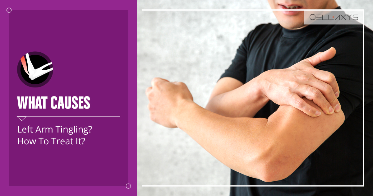 What Causes Left Arm Tingling? How To Treat It? Cellaxys