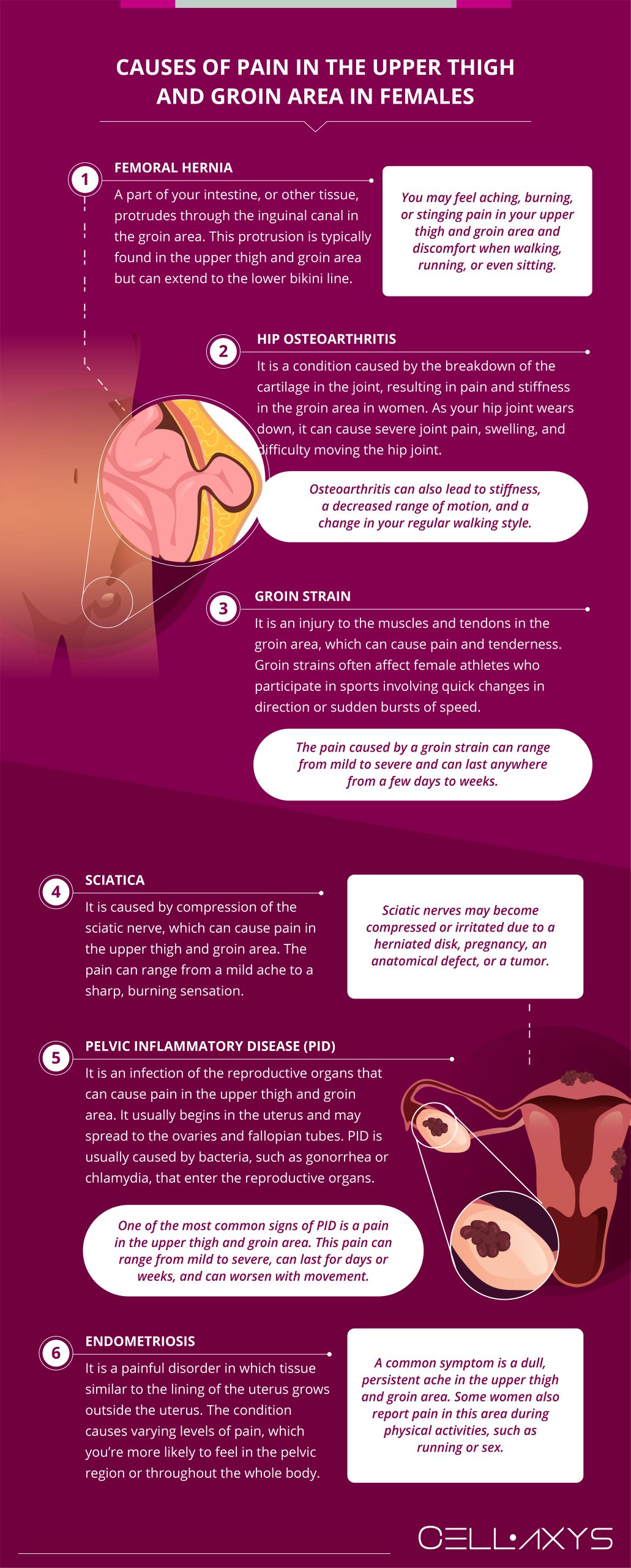 Causes of Pain in the Upper Thigh and Groin Area in Females 