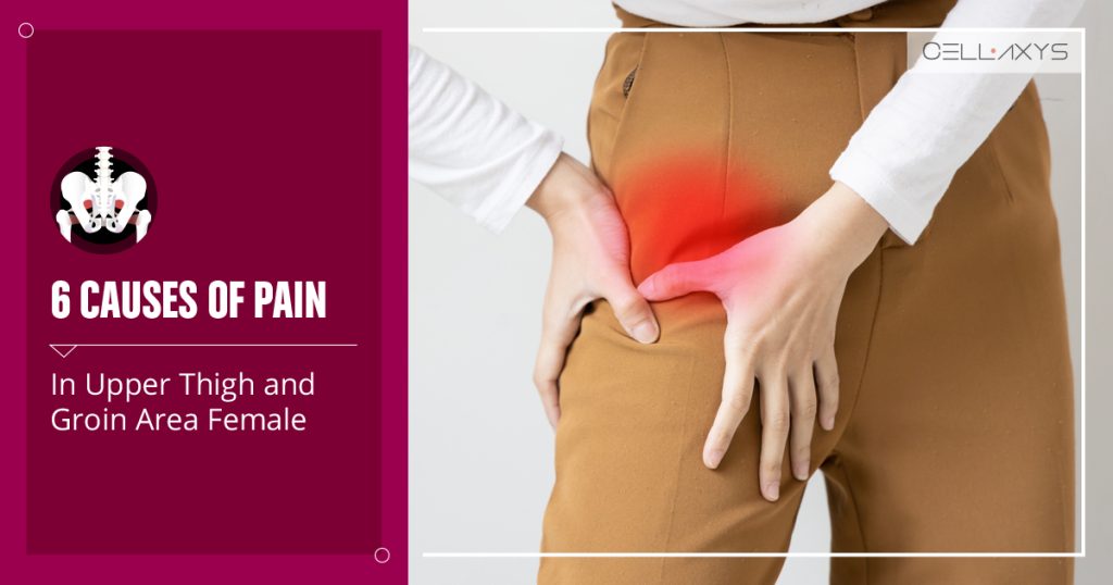 What Can Cause Hip Pain in Women?