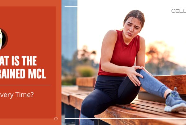 sprained mcl recovery time
