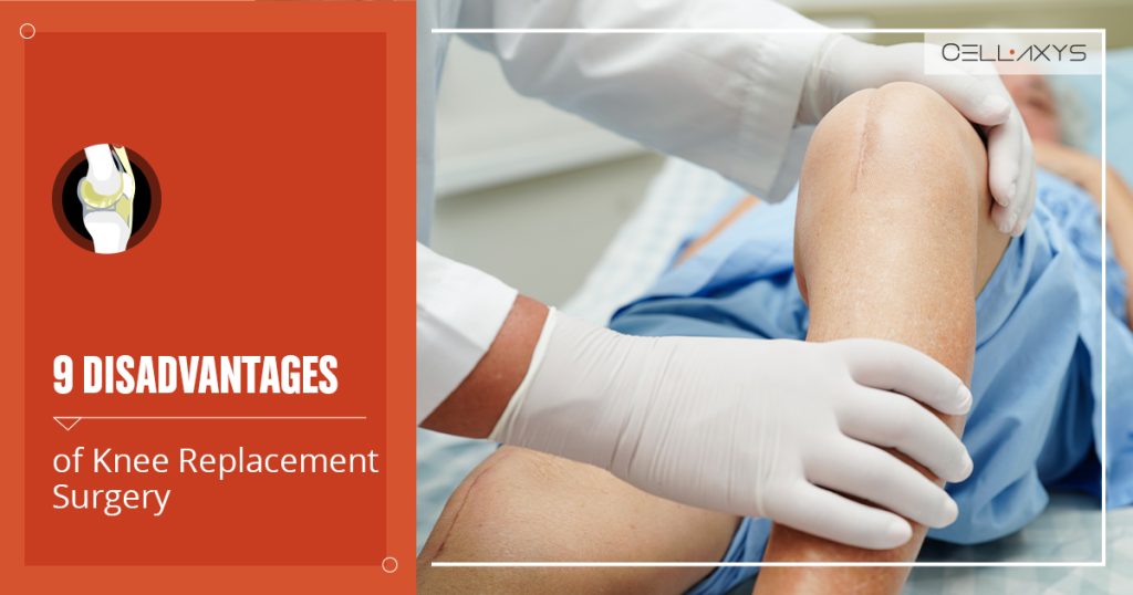 disadvantages of knee replacement surgery