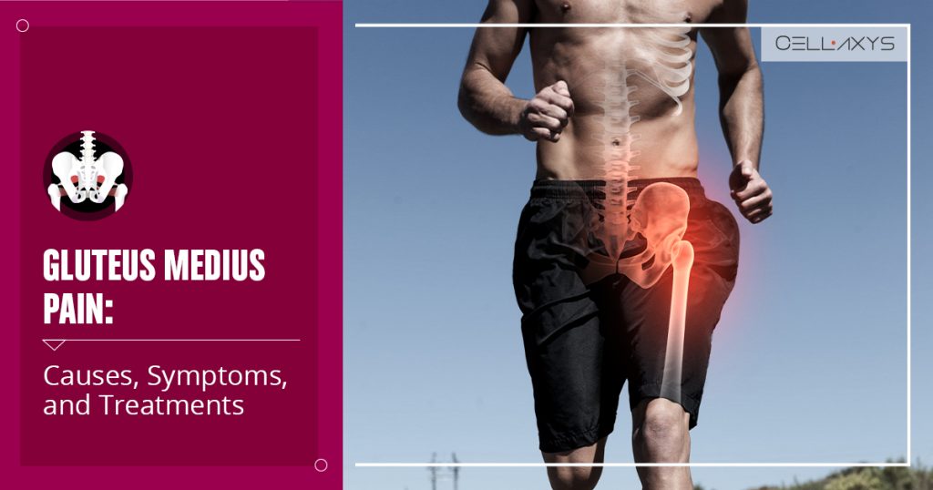 gluteus medius pain
