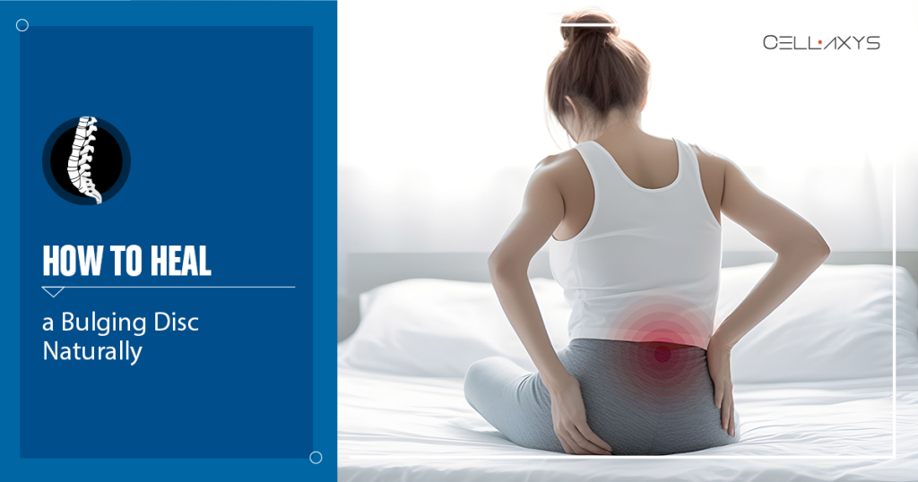 how to heal a bulging disc naturally
