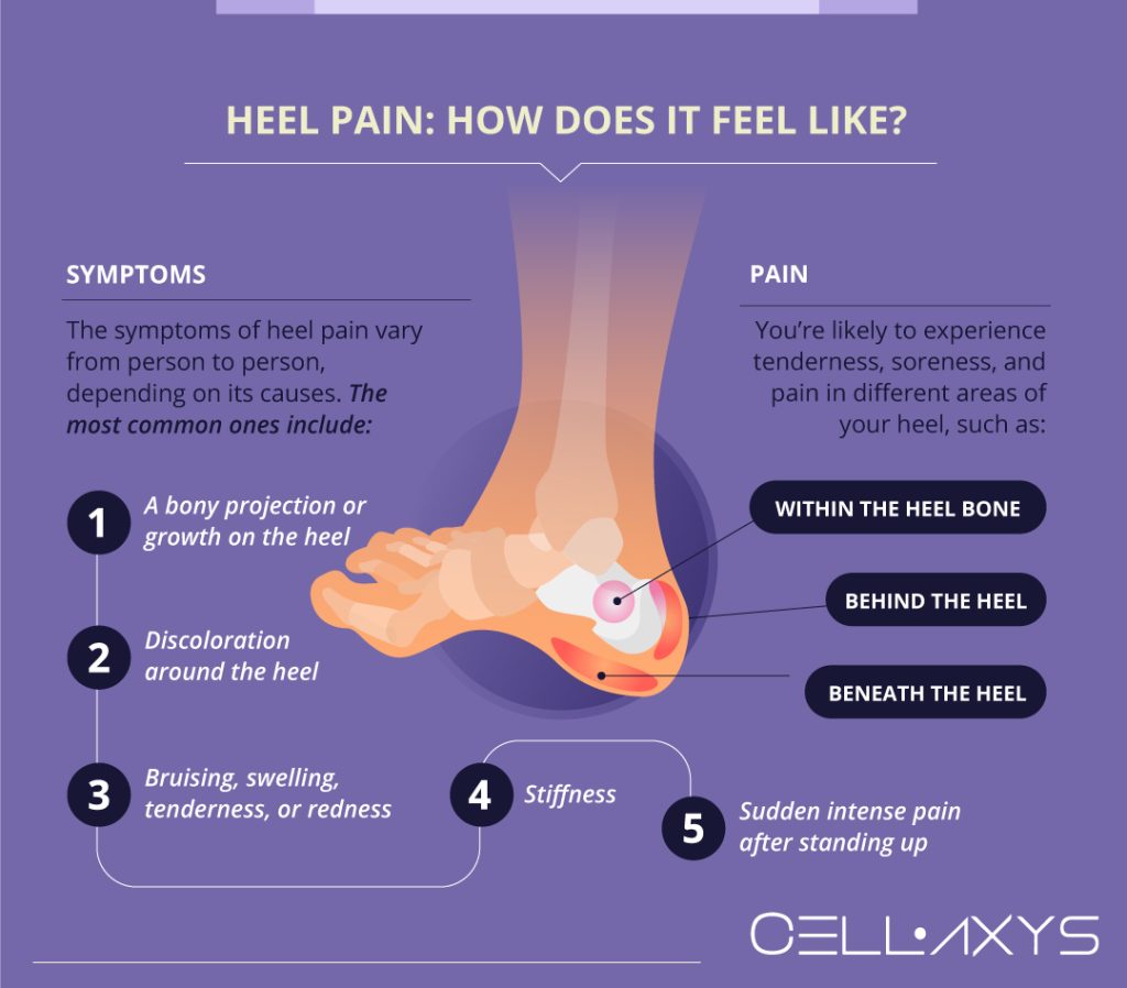 Severe Heel Pain, Can't Walk: How To Treat It? - Cellaxys