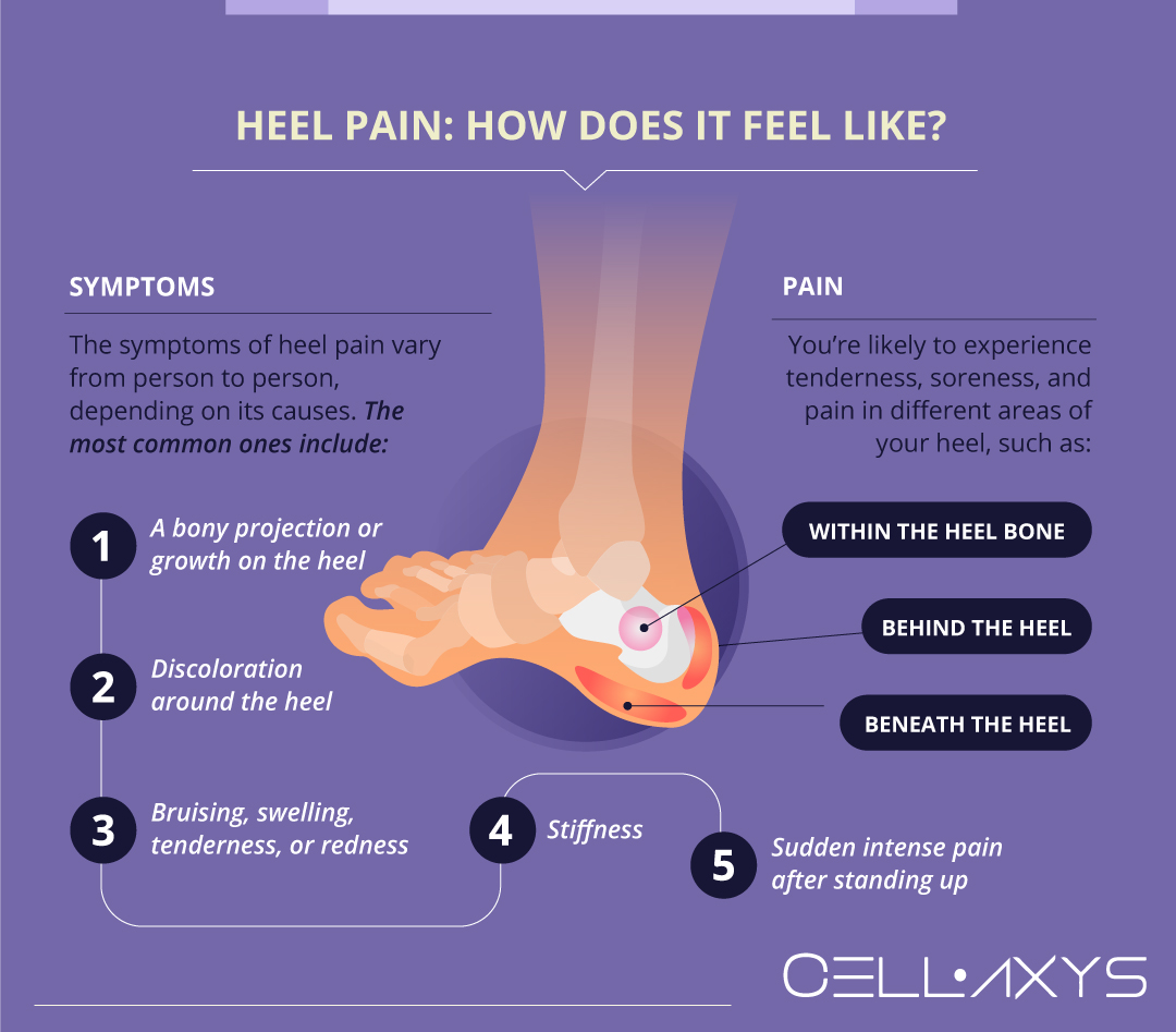 Heel Pain: How Does It Feel Like?