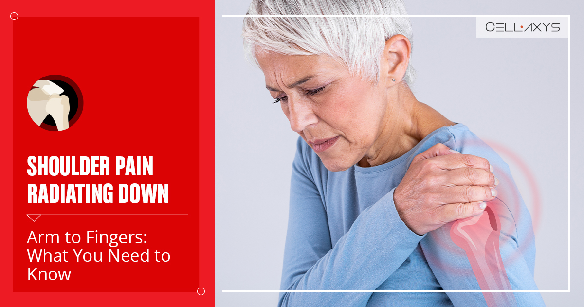 shoulder pain radiating down arm to fingers