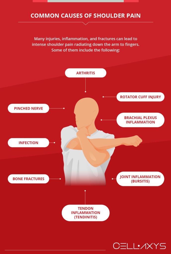 Shoulder Pain Radiating Down Arm To Fingers: What You Need To Know ...