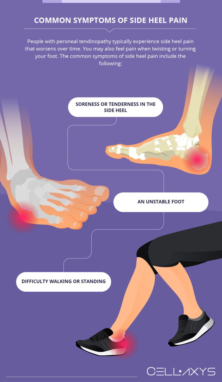 Side Heel Pain: What You Should Know - Cellaxys