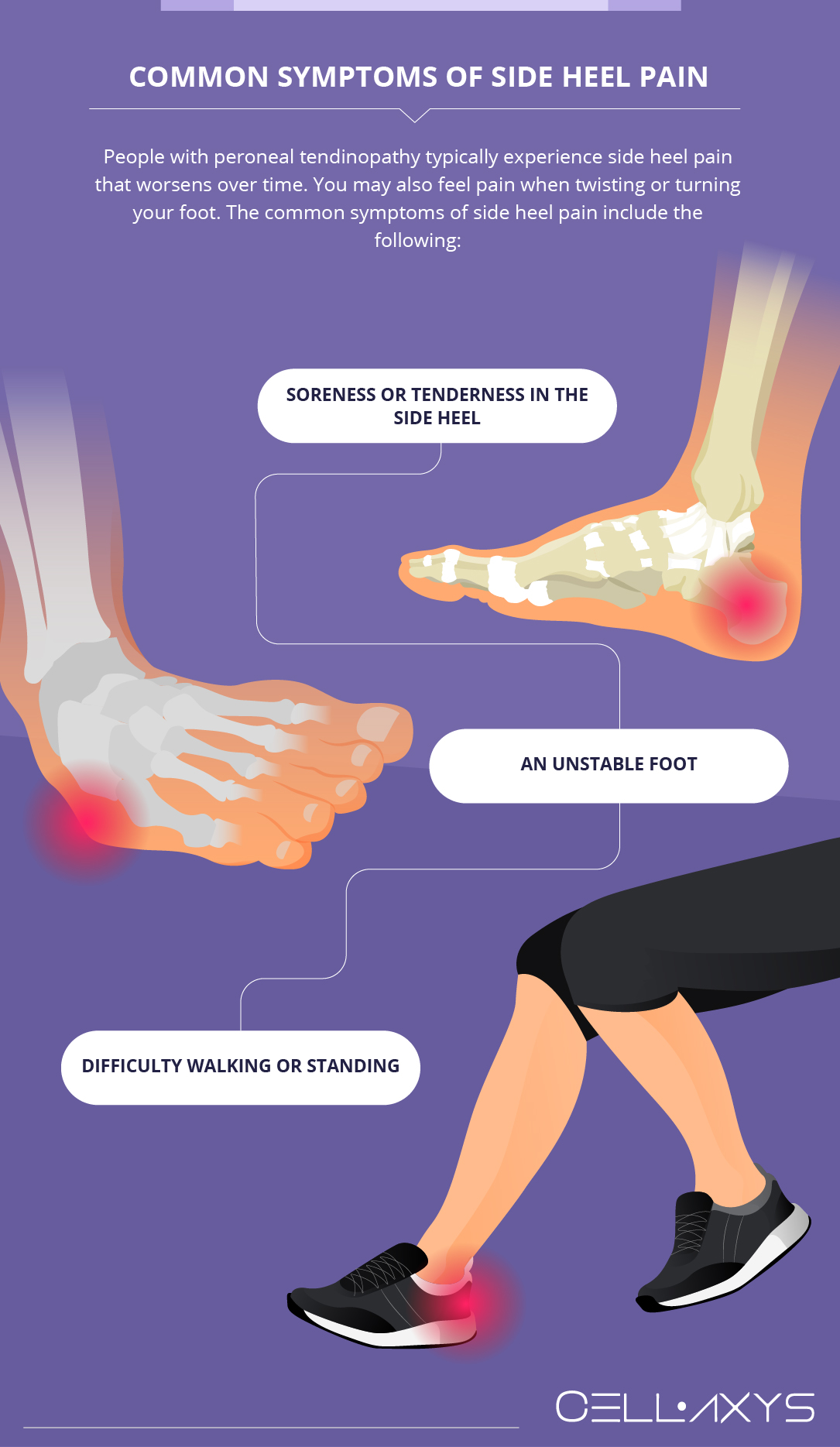Common Symptoms of Side Heel Pain