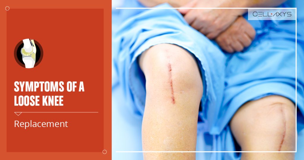 symptoms of a loose knee replacement