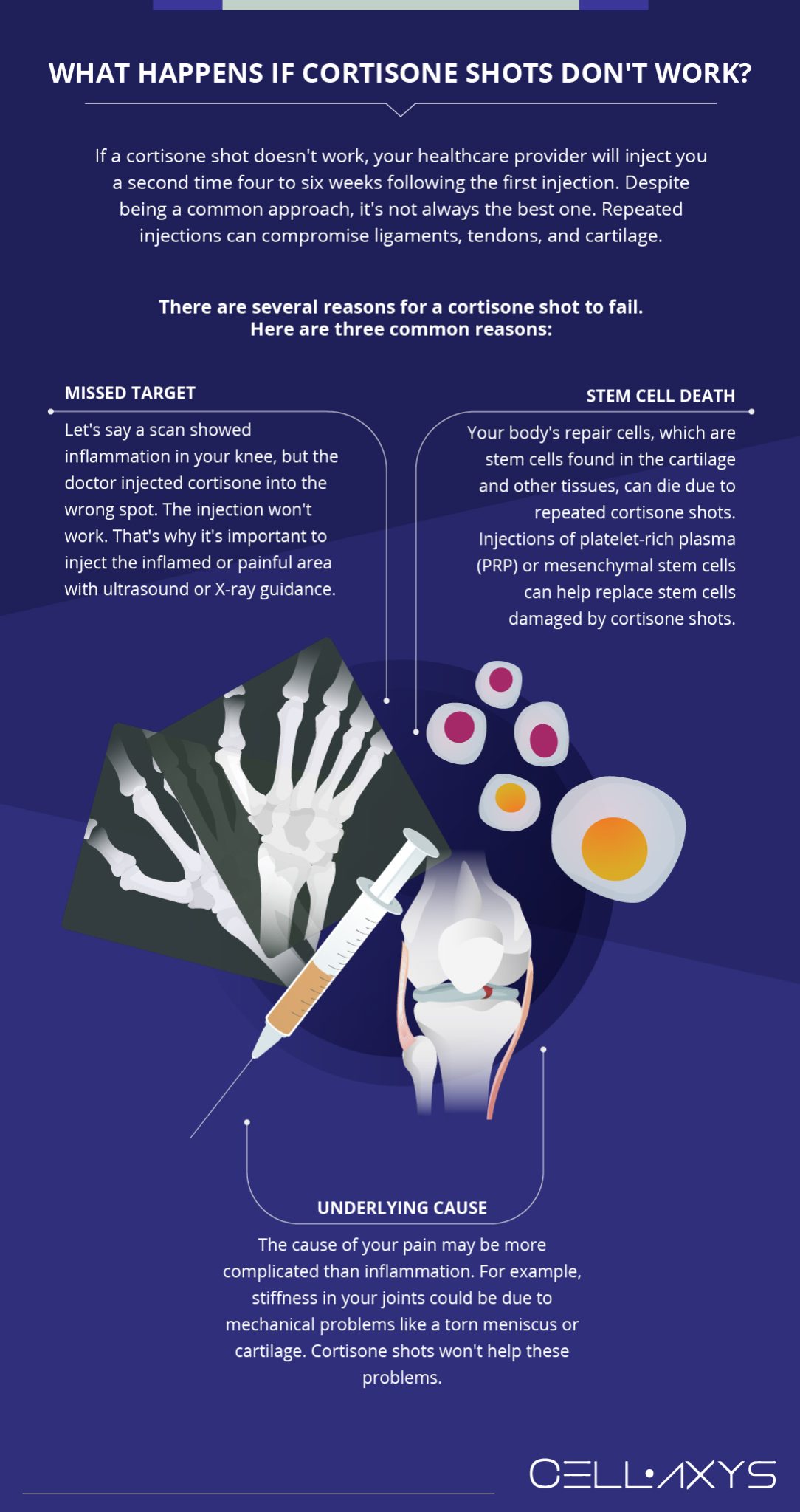 What If Cortisone Shot Doesn't Work Cellaxys