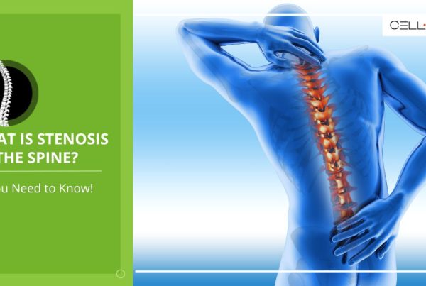 what is stenosis of the spine
