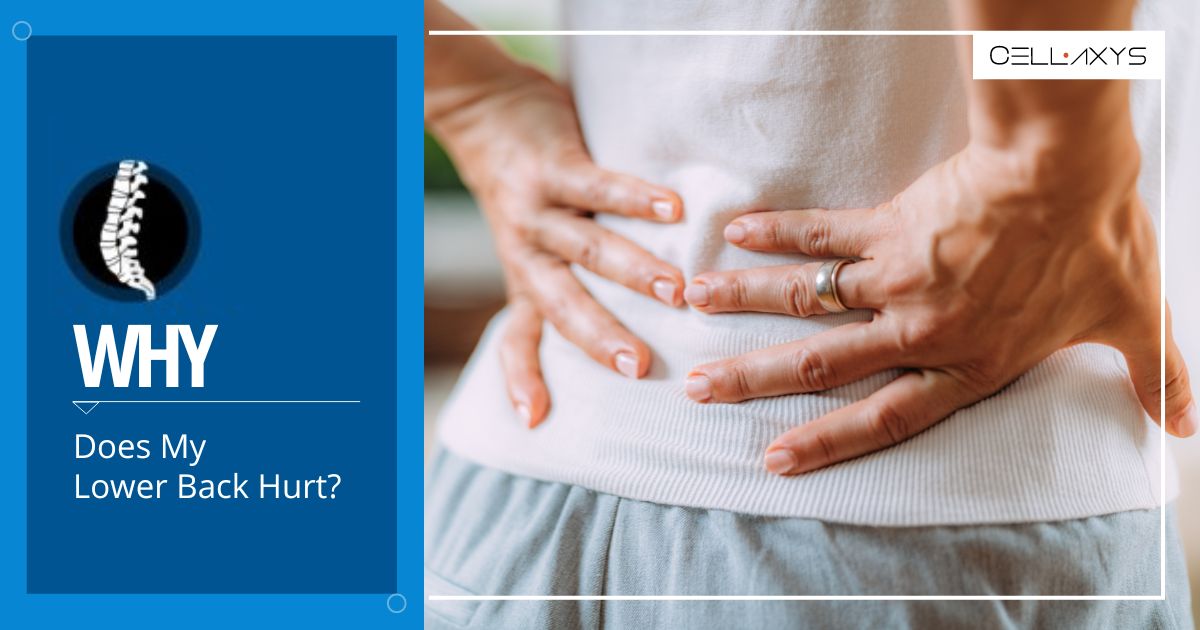 Why Does My Lower Back Hurt? Cellaxys