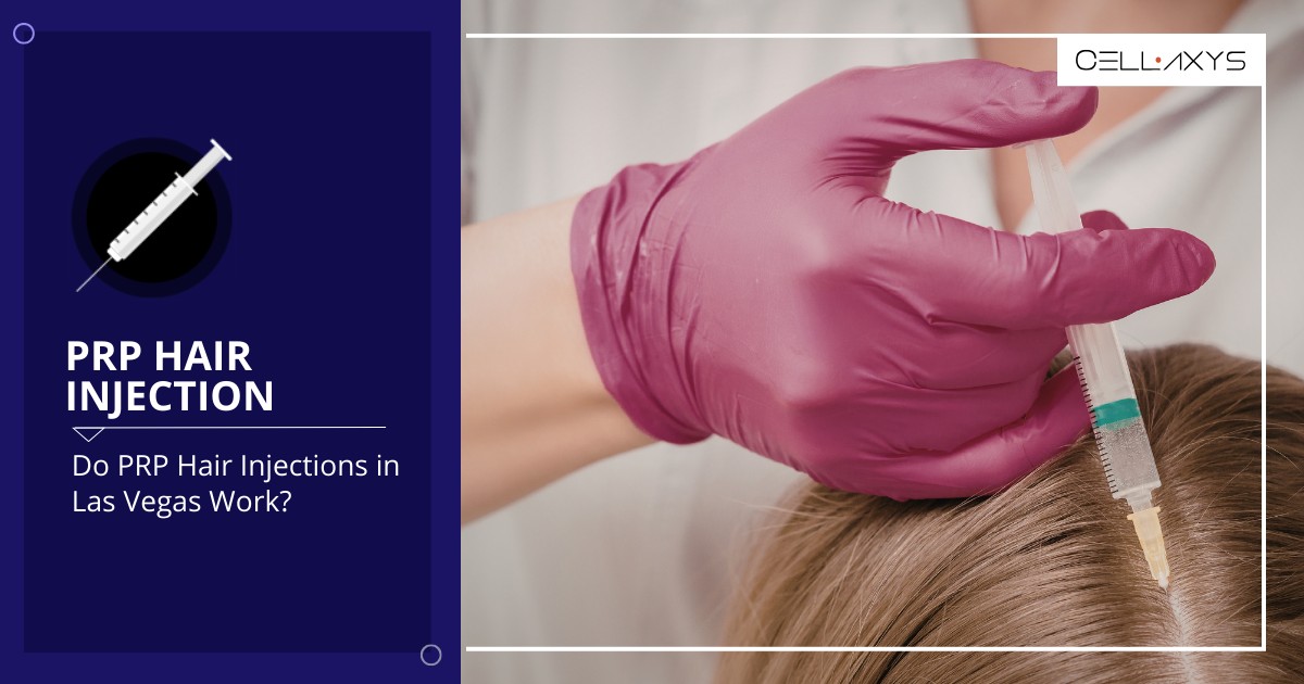 Do PRP Hair Injections In Las Vegas Work? - Cellaxys