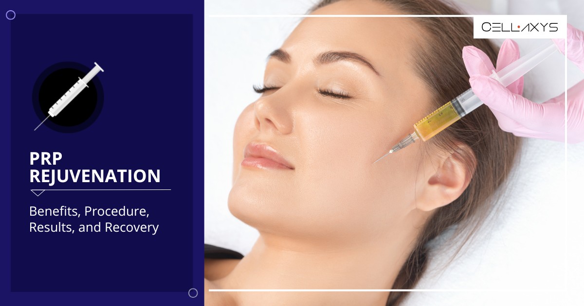 PRP Rejuvenation In Las Vegas: Benefits, Procedure, Results, And ...